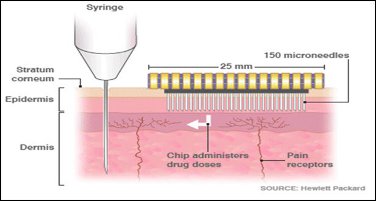 Figure 1: The nerve stimulation and needle length of a hypodermic medication compared to microneedles (MyLifesspan.com. 2018)