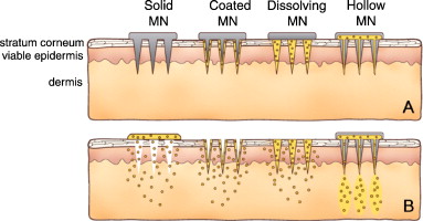 Figure 2: Different types of microneedles and their release mechanisms (Yeu <em>et al</em>., 2012)